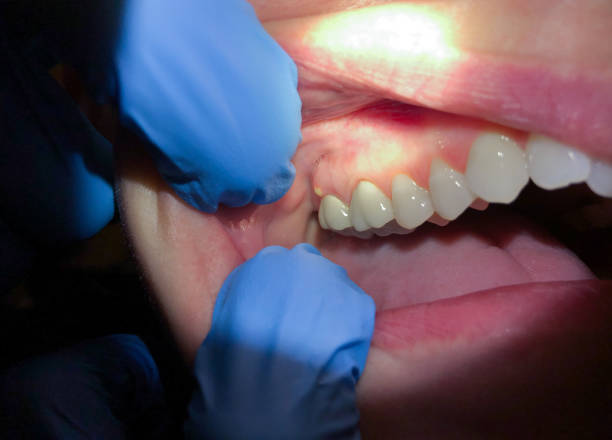 Best Emergency Denture Repair in Northlake, TX